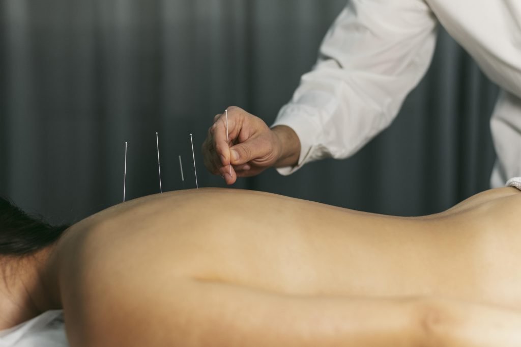 Acupuncturist in Lelystad